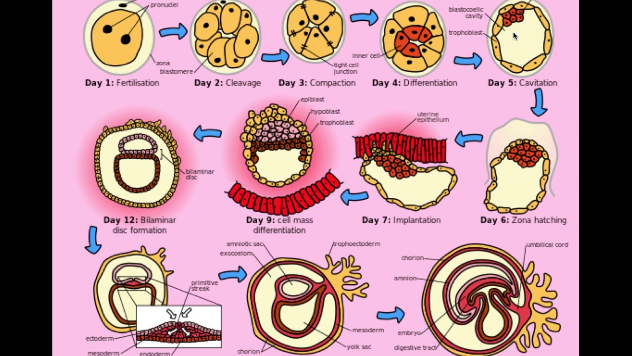 Multiple Gestation (Twins) - CRASH! Medical Review Series