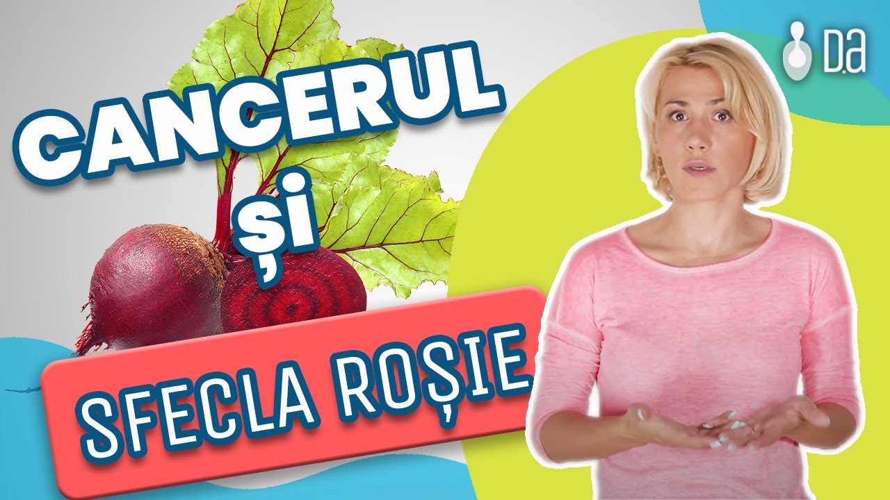 Sfecla rosie, o zestre proasta pentru pacientii cu cancer-Doctor in nutritie oncologica Diana Artene