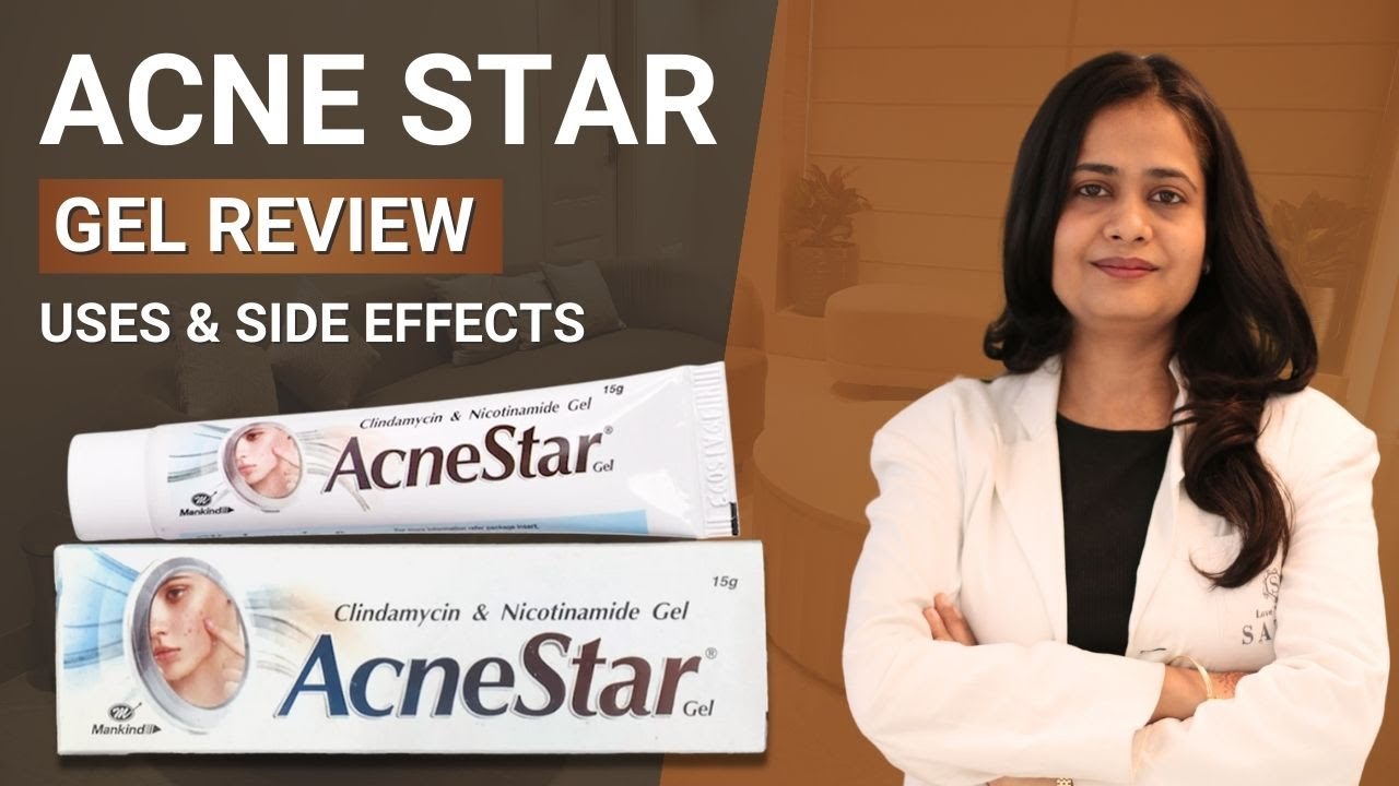 Acnestar gel review | Acnestar gel | Acne star for Acne & Pimples | Acnestar gel use & side effects