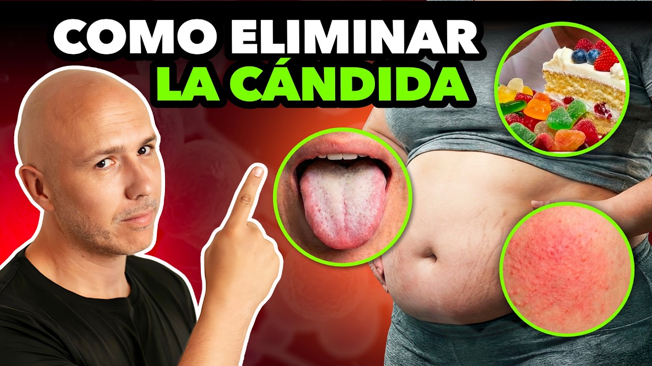 ¡NO Es Tu Culpa! Estas Comiendo Más Por Que Tienes CÁNDIDA ¿Cómo ELIMINAR La CÁNDIDA?