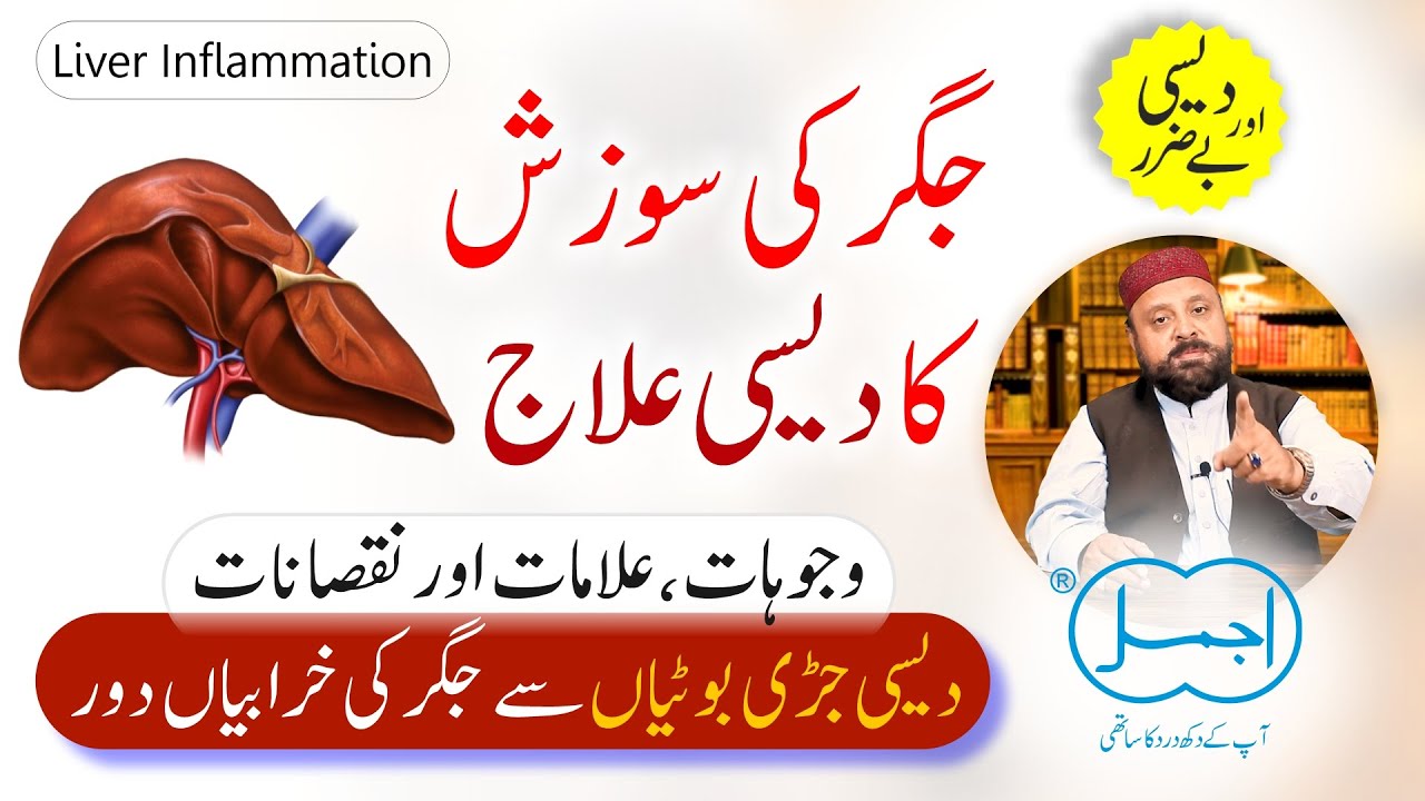 Jigar Ki Sozish Ka ilaj | Hepatitis ka ilaj | Liver Inflammation Herbal Treatment | Liver Detox