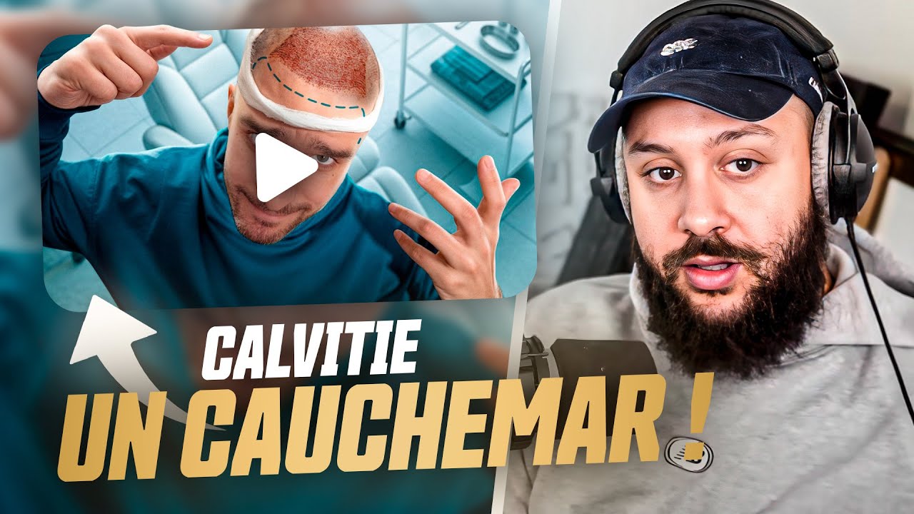 Un Chauve réagit aux DANGERS de la Greffe de Cheveux (React Dr. Nozman)