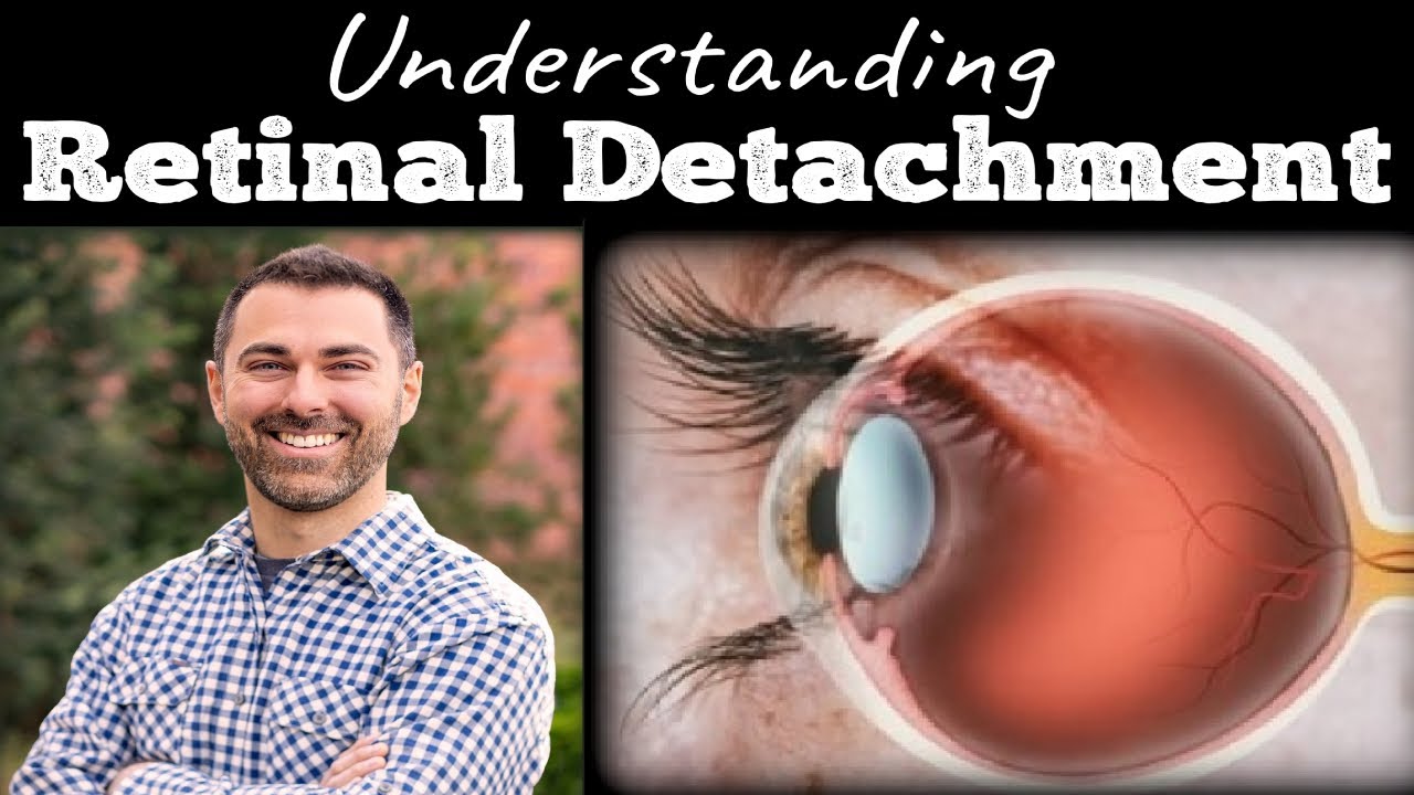 Retinal Detachment | Signs, Symptoms, Diagnosis & Treatment
