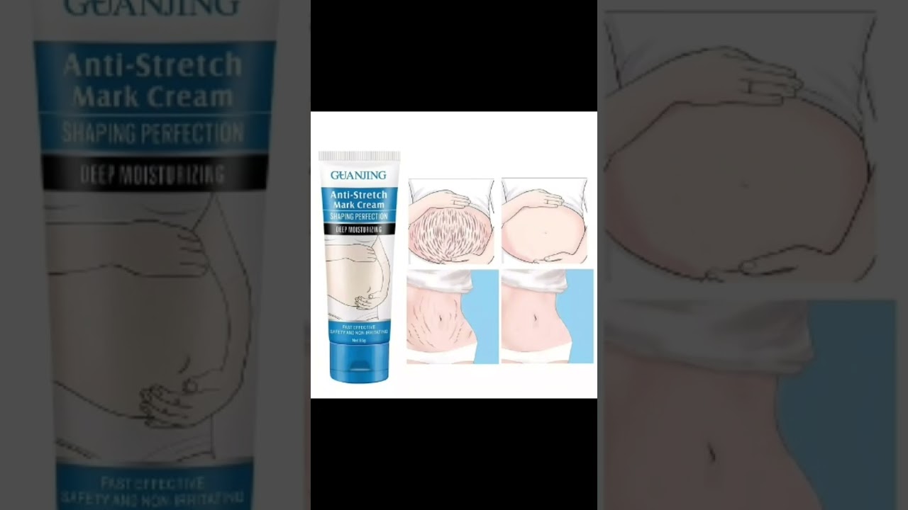 Anti Stretch Mark cream .. Free Delivery 