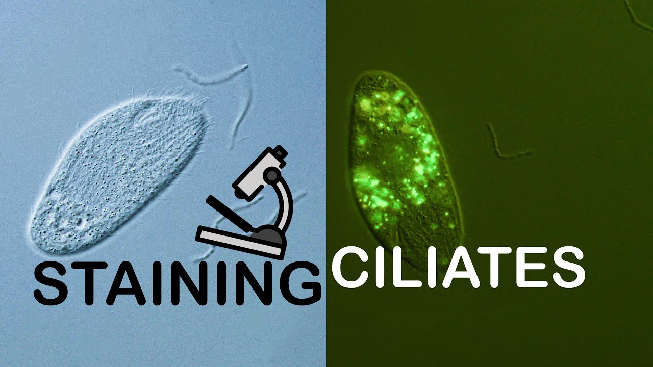 Staining Ciliates for fluorescent microscopy