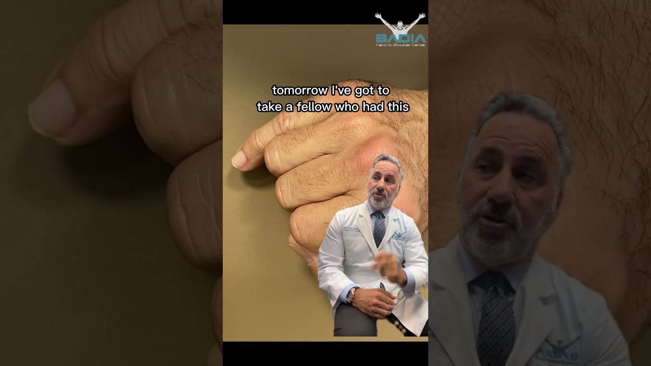 Don't ignore a finger fracture! Dr.Badia Explains why you should see a specialist