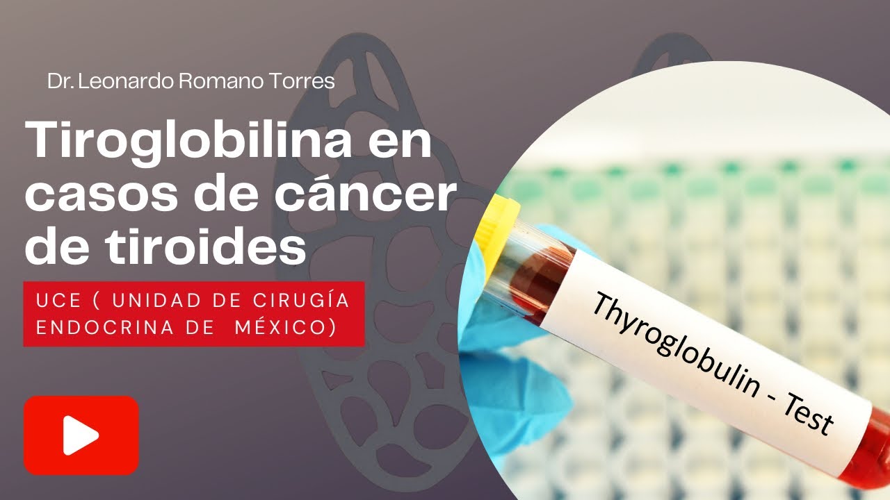 ¿Es importante la Tiroglobulina en el Seguimiento del Cáncer de Tiroides? | Cirugía de tiroides