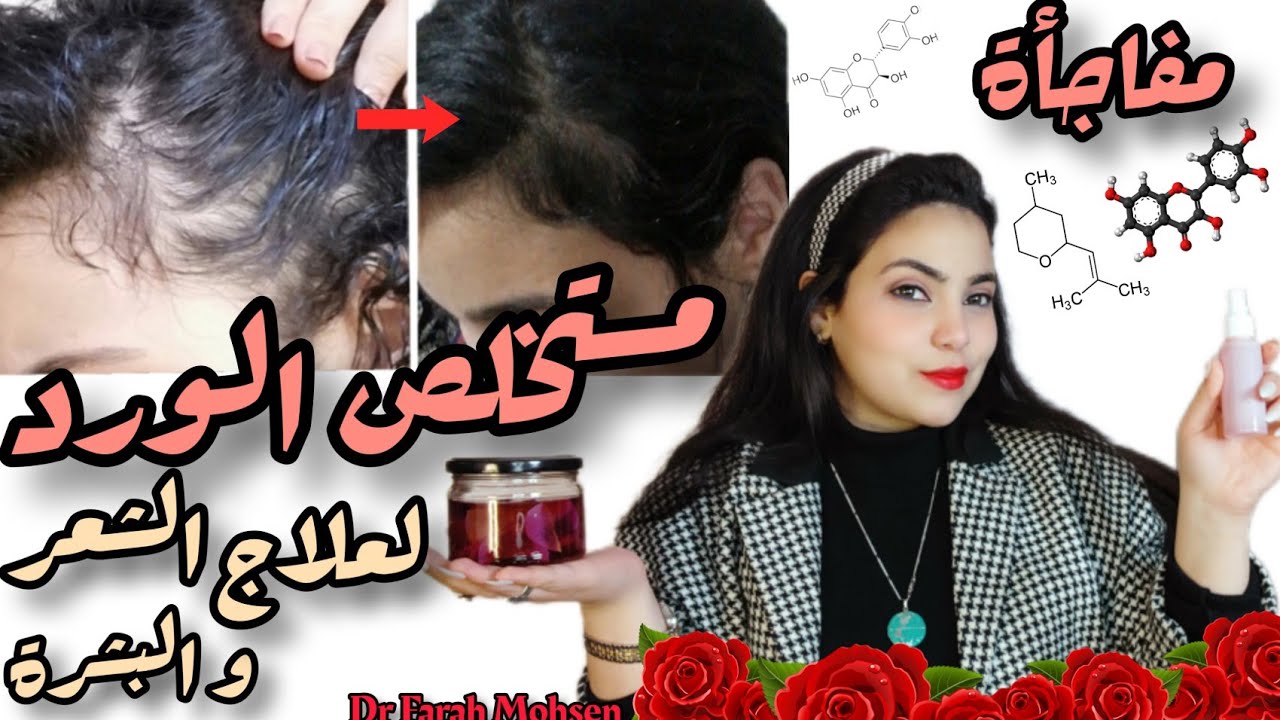 مفاجأة..ماء الورد ! أفضل علاج للصلع و تساقط الشعر و مشاكل البشرة و الصحة العامة🌹🥛| فرح محسن Drjoy
