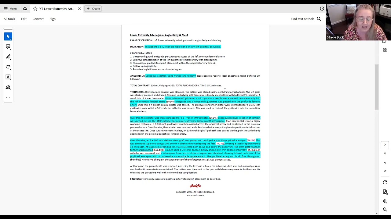 10/18/23 Cracking the IR Code: Lower Extremity Arteriogram, Angioplasty & Stent
