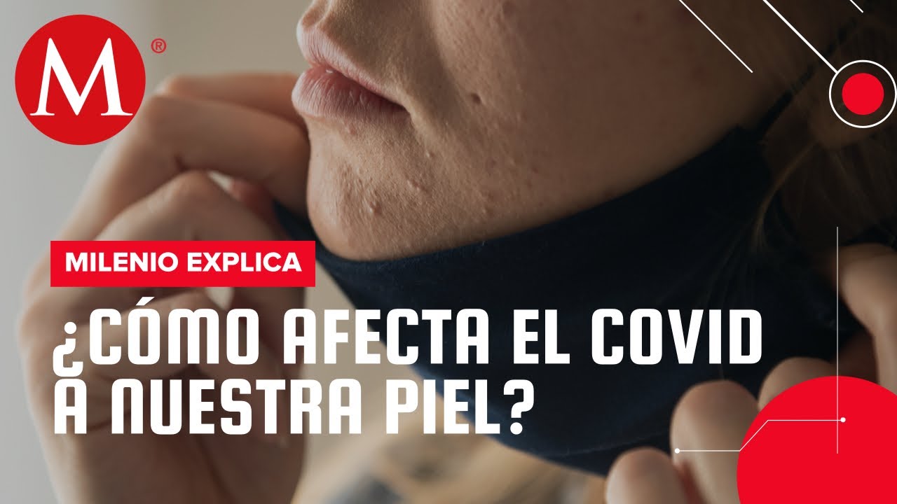 &iquest;Covid-19 en la piel? | Milenio Explica
