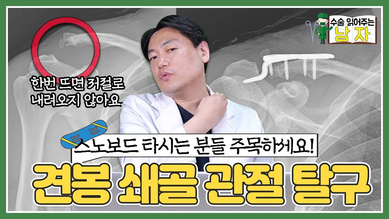 한번 뜨면 저절로 내려오지 않아요😱｜견봉 쇄골 관절 탈구 케이스｜수술 읽어주는 남자👨‍⚕️