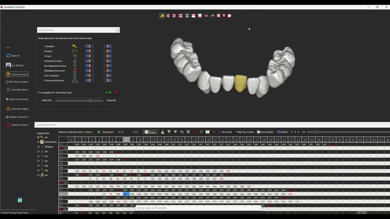 GuideMia OrthoPlus   StagePlanning