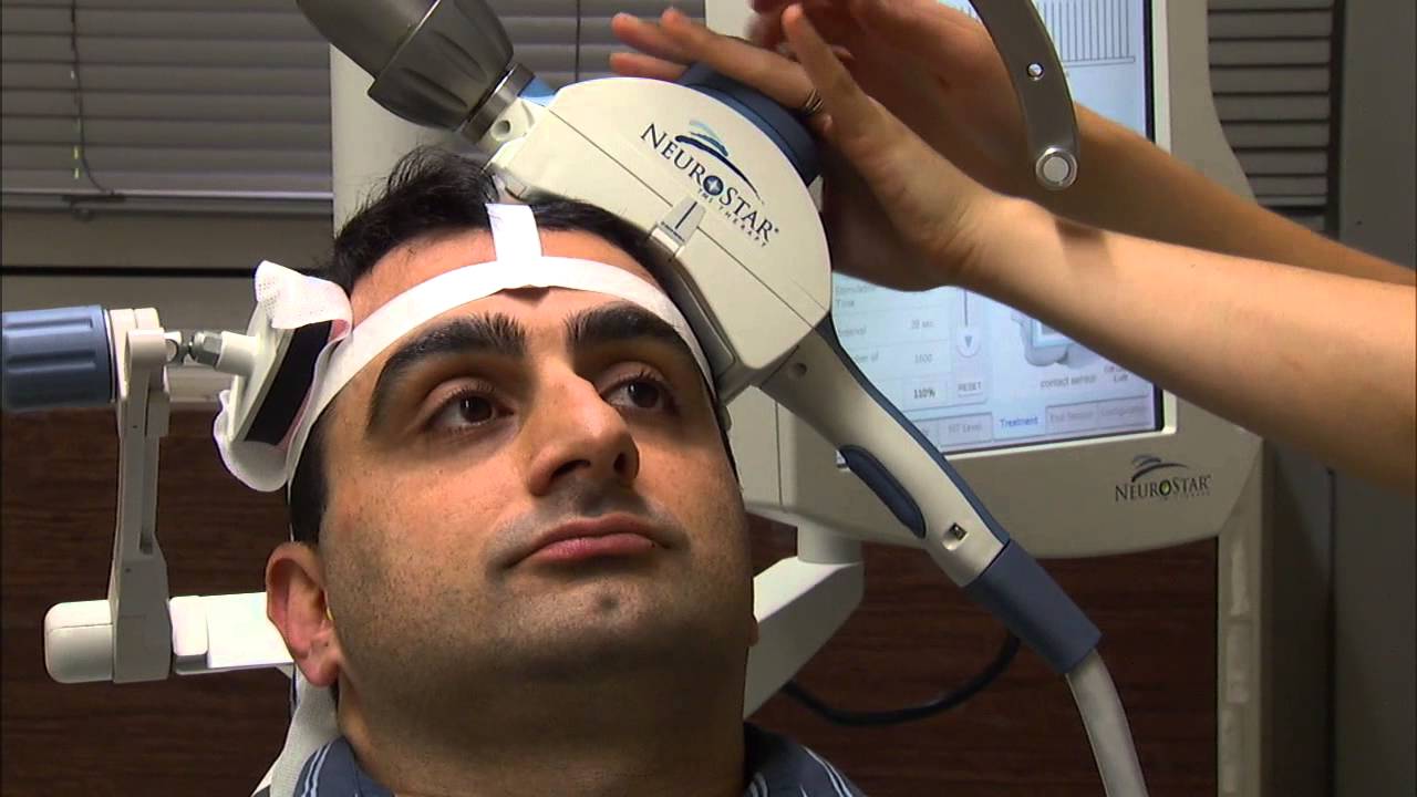 TMS Brain Stimulation Can Help Combat Depression