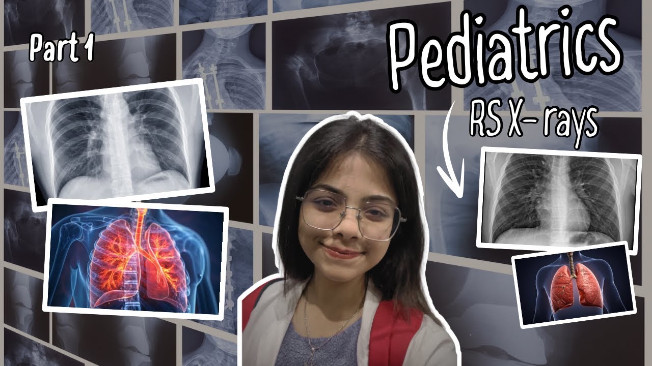Respiratory System X-rays in Pediatrics | High Yield Exam Spotters (Part 1)