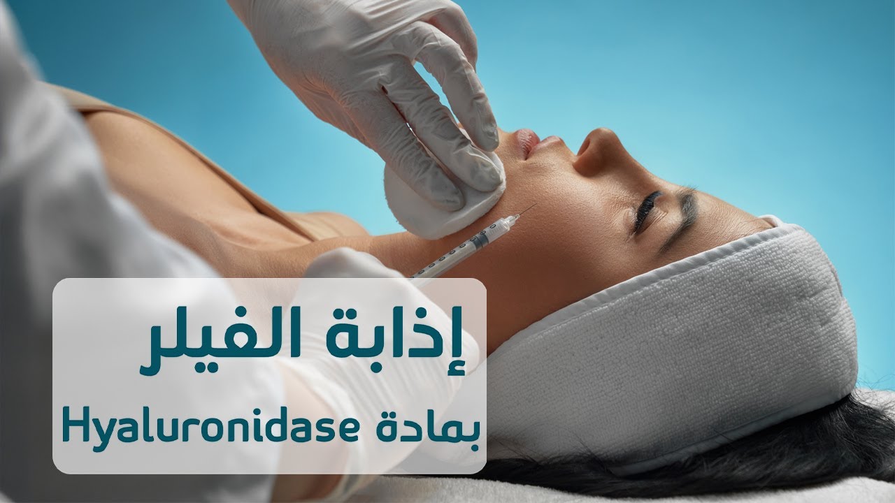 إذابة الفيلر بمادة Hyaluronidase د. رشا الدبّاح
