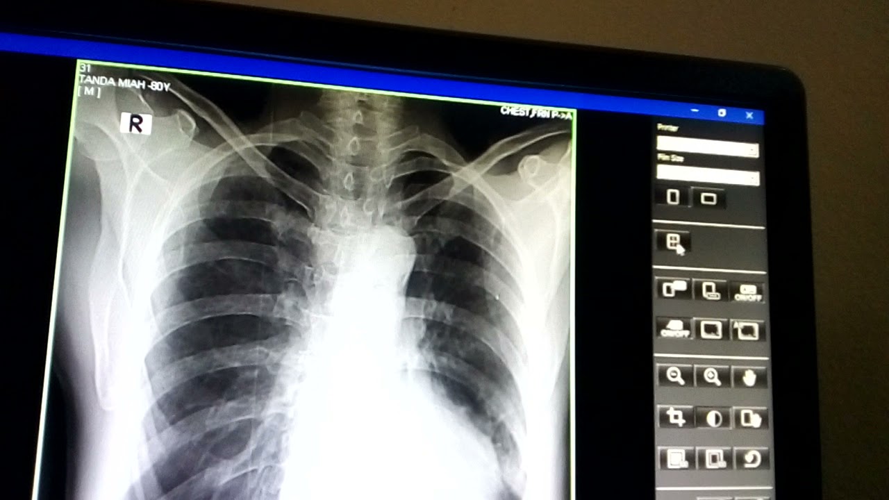 fuji CR film মেশিনে কিভাবে x-ray করতে হয় তার সম্পুর্ণ ভিডিও দেখে শিখুন