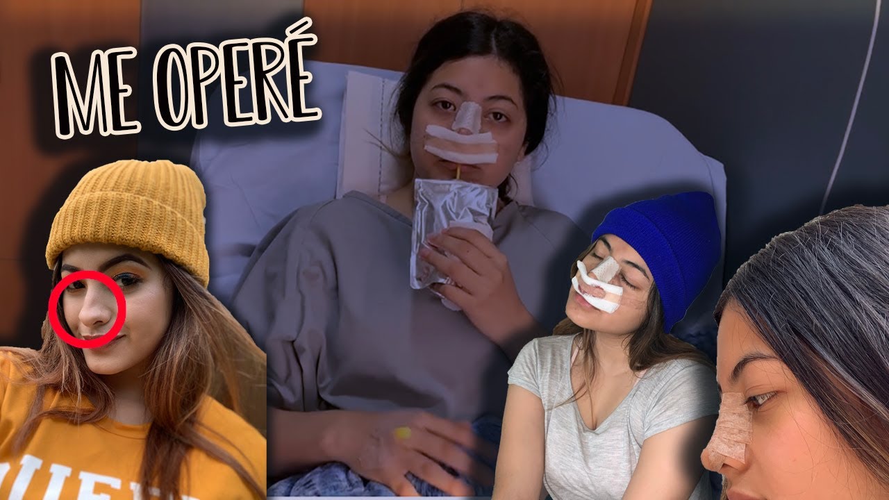 MI RINOPLASTÍA DÍA A DÍA | Pau Ortiz