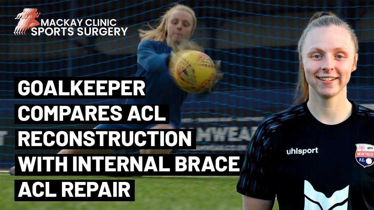 Footballer compares InternalBrace ACL Repair with ACL reconstruction