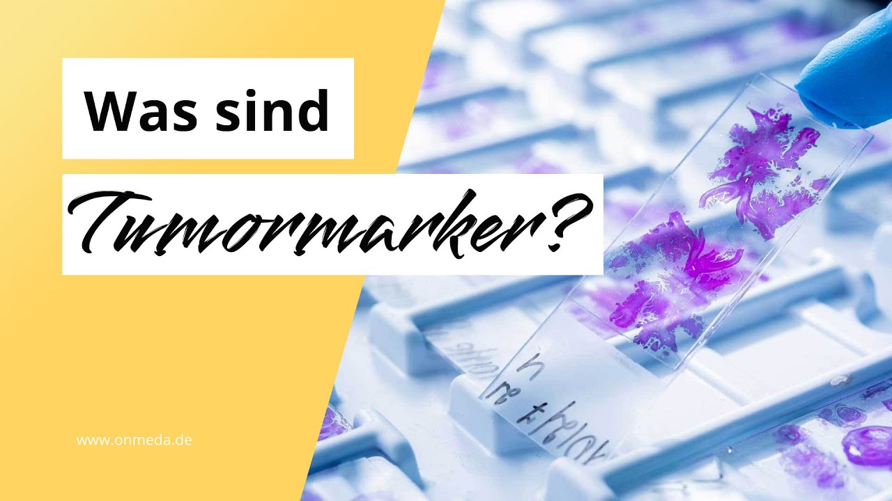 Was sind Tumormarker?