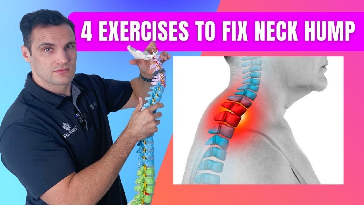 Fix The Bone Sticking Out On The Back Of Neck