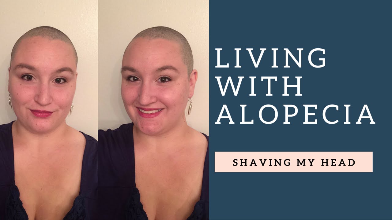 SHAVING MY HEAD | my journey with alopecia