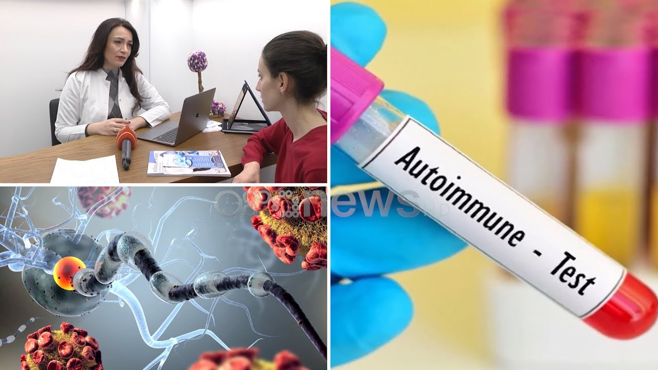Rastet e sëmundjeve autoimune, pas atyre tumoreve, këto patologji janë më të kushtueshme për trajtim