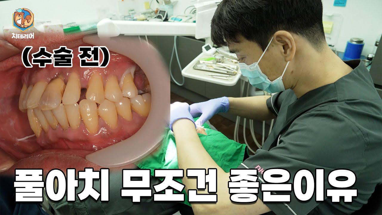 풀아치 무조건 추천하는 이유는 바로 이것