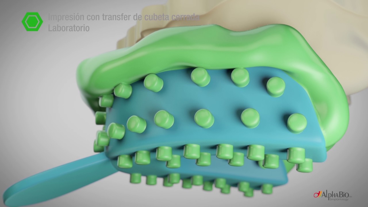 Rehabilitación atornillada HBC | Alpha-Bio Tec.
