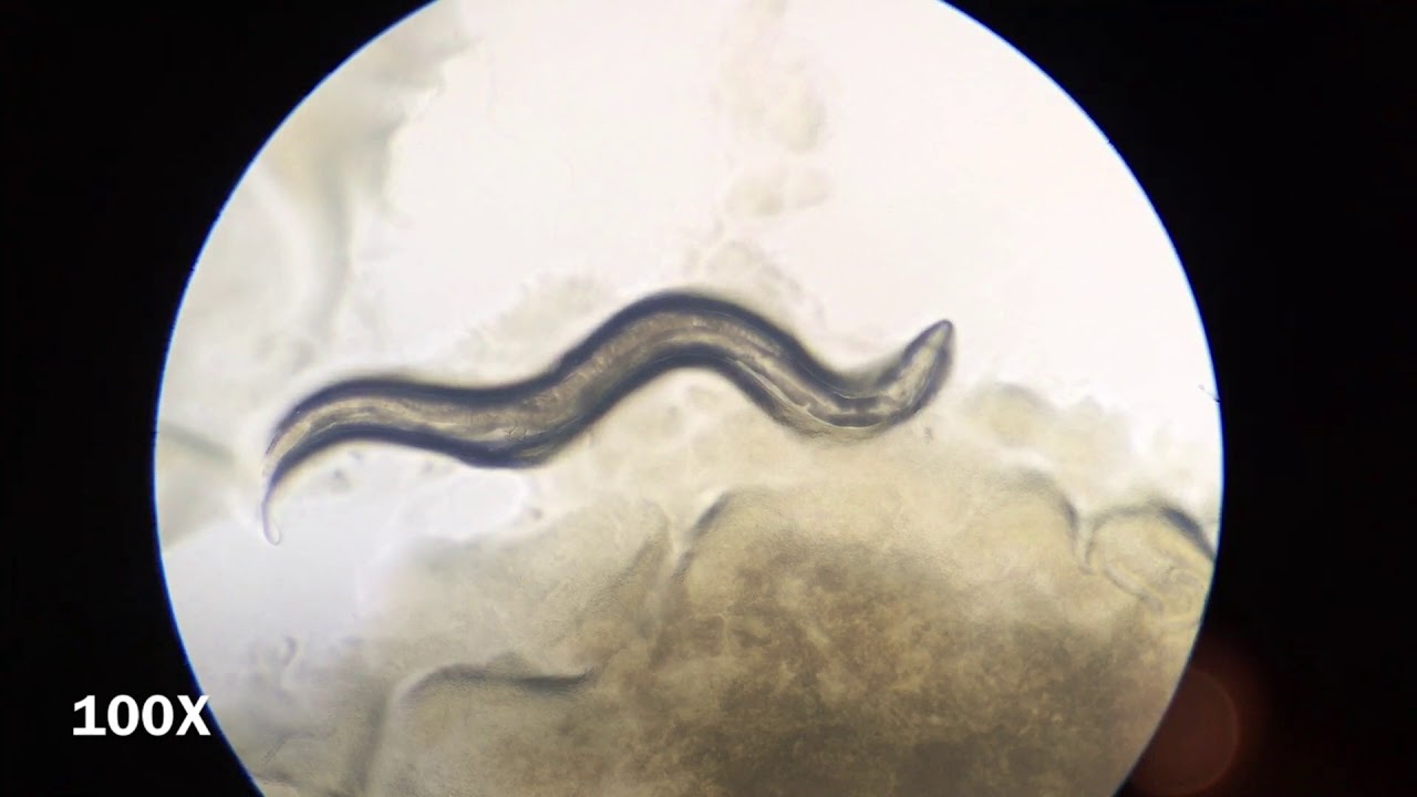 C. elegans Under the Microscope