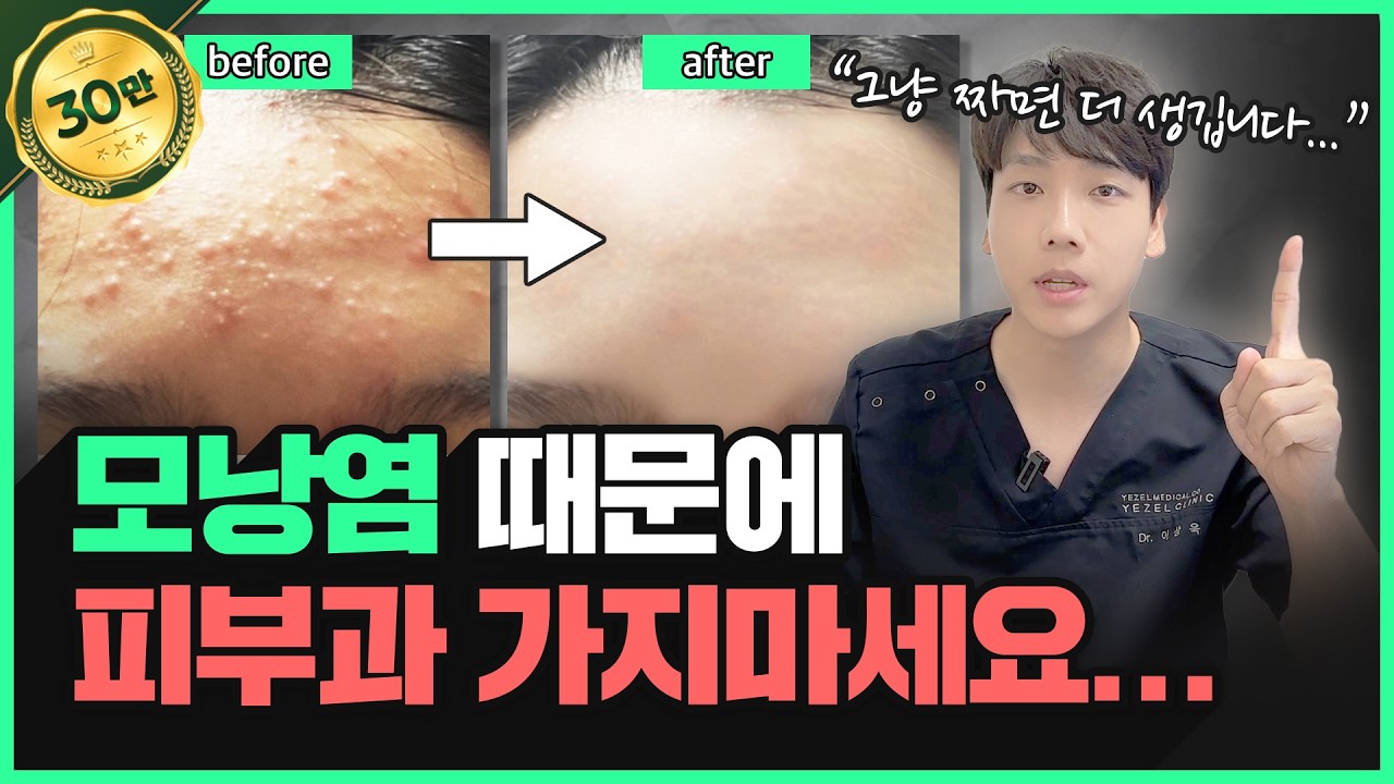 짜면 번지는 모낭염...😭 모낭염 & 여드름 구분법, 관리법 전부 공개! | 모냥염은 그냥 짜면 안돼요ㅠㅠ