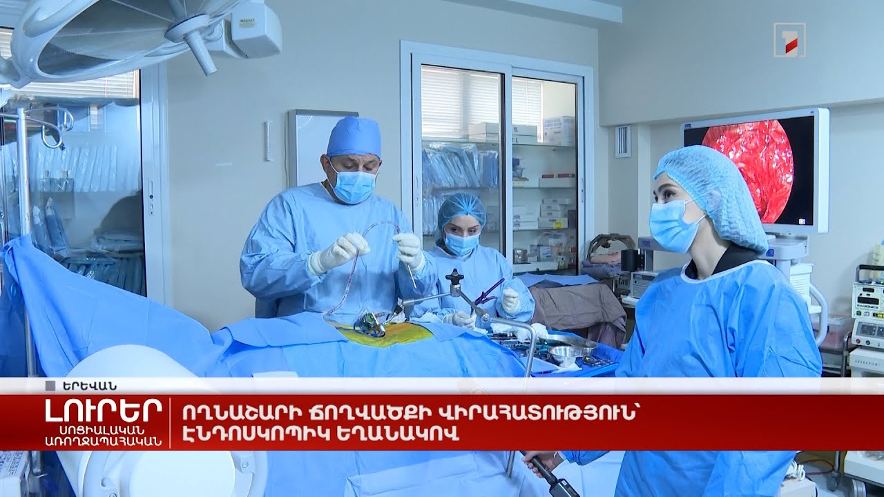 Ողնաշարի ճողվածքի վիրահատություն՝ էնդոսկոպիկ եղանակով