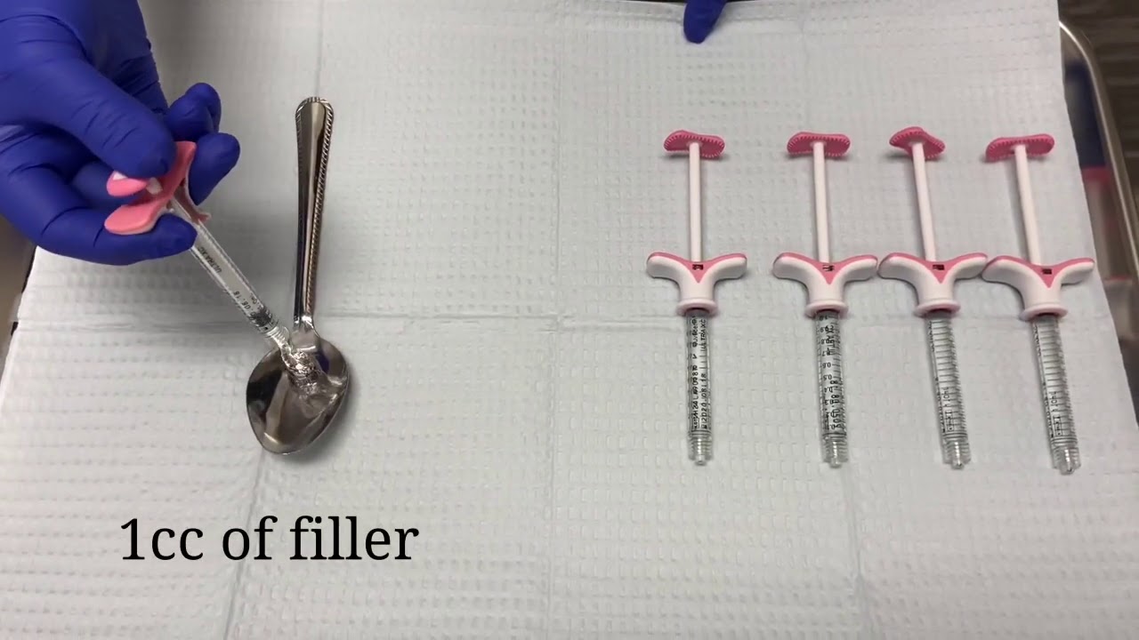 What does 5cc of filler look like?