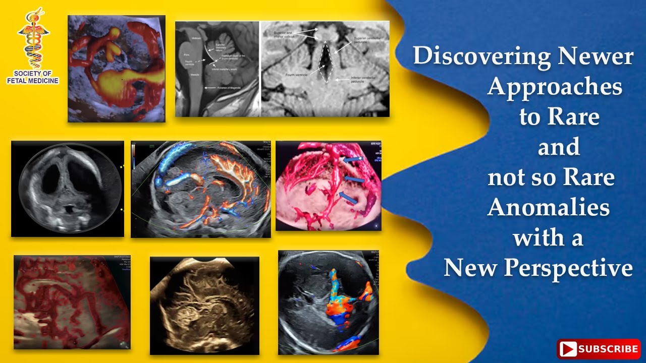 Discovering Newer Approaches to Rare and not so Rare Anomalies with a New Perspective