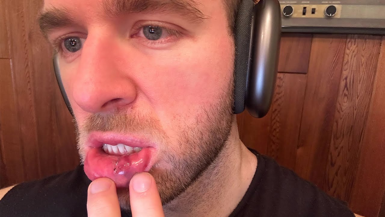 I Just Got Out Of Surgery