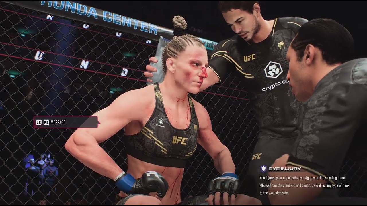 What a beating lolz 🤦🏾‍♂️🤣😴💥🎯💣