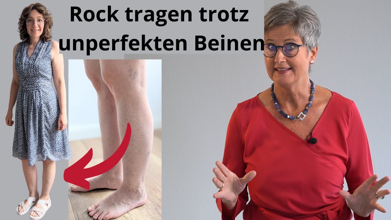 Bein zeigen trotz Besenreiser, Venen,…-5 praktische Tipps