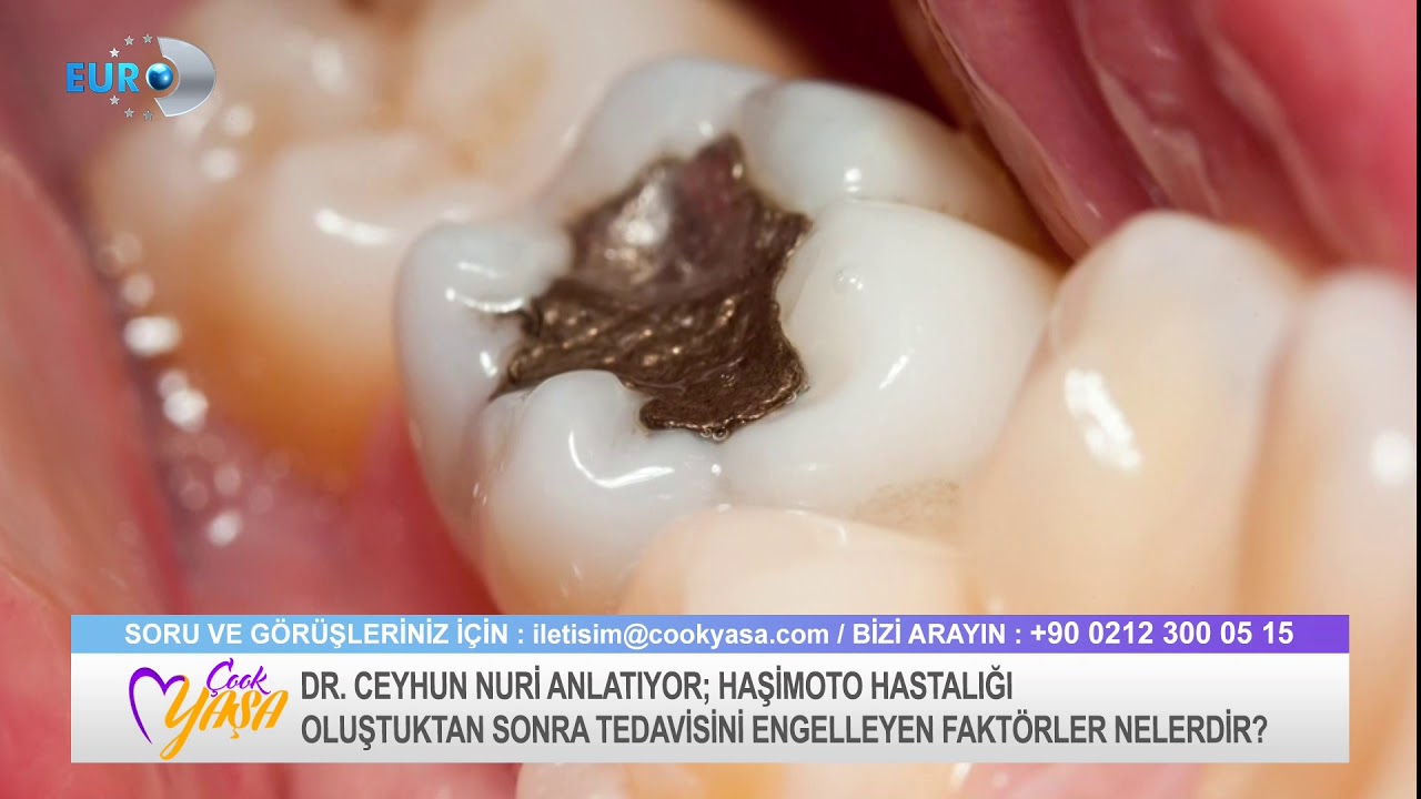 DOKTOR CEYHUN NURİ - HAŞİMOTO 4