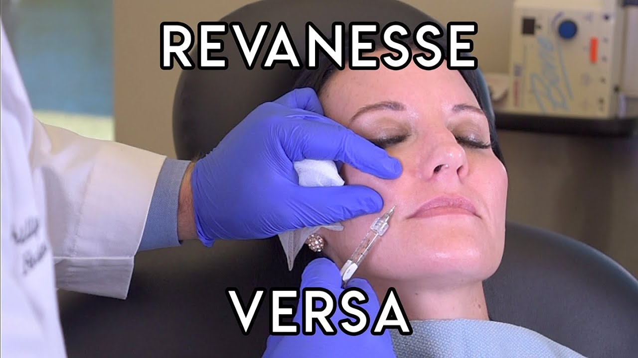 Revanesse Versa