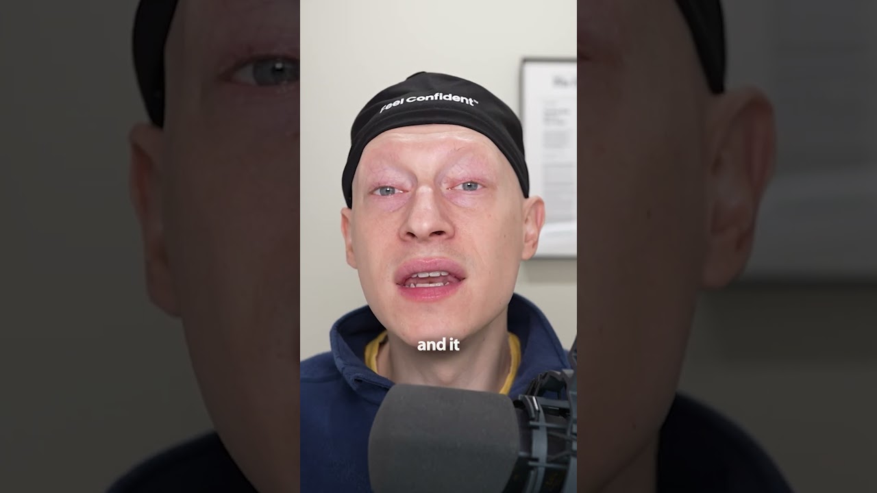 Reasons NOT To Get A Lip Lift