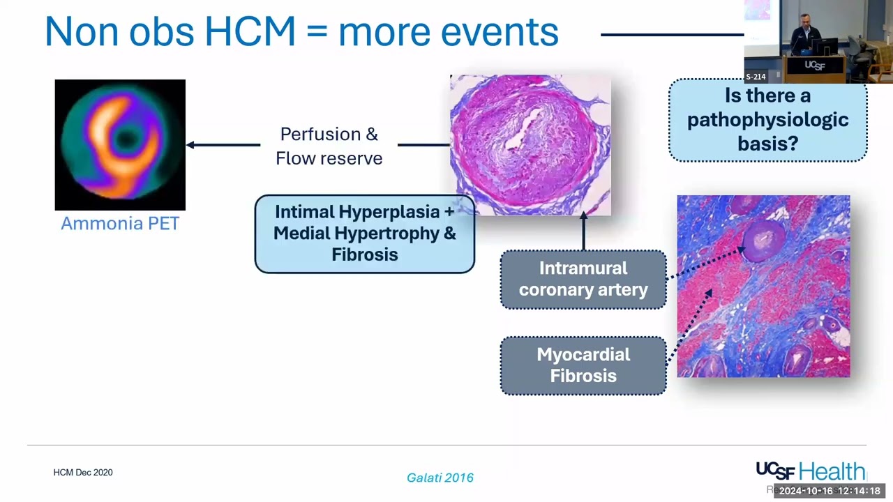 Cardiology Grand Rounds -Ted Abraham, MD - October 16, 2024