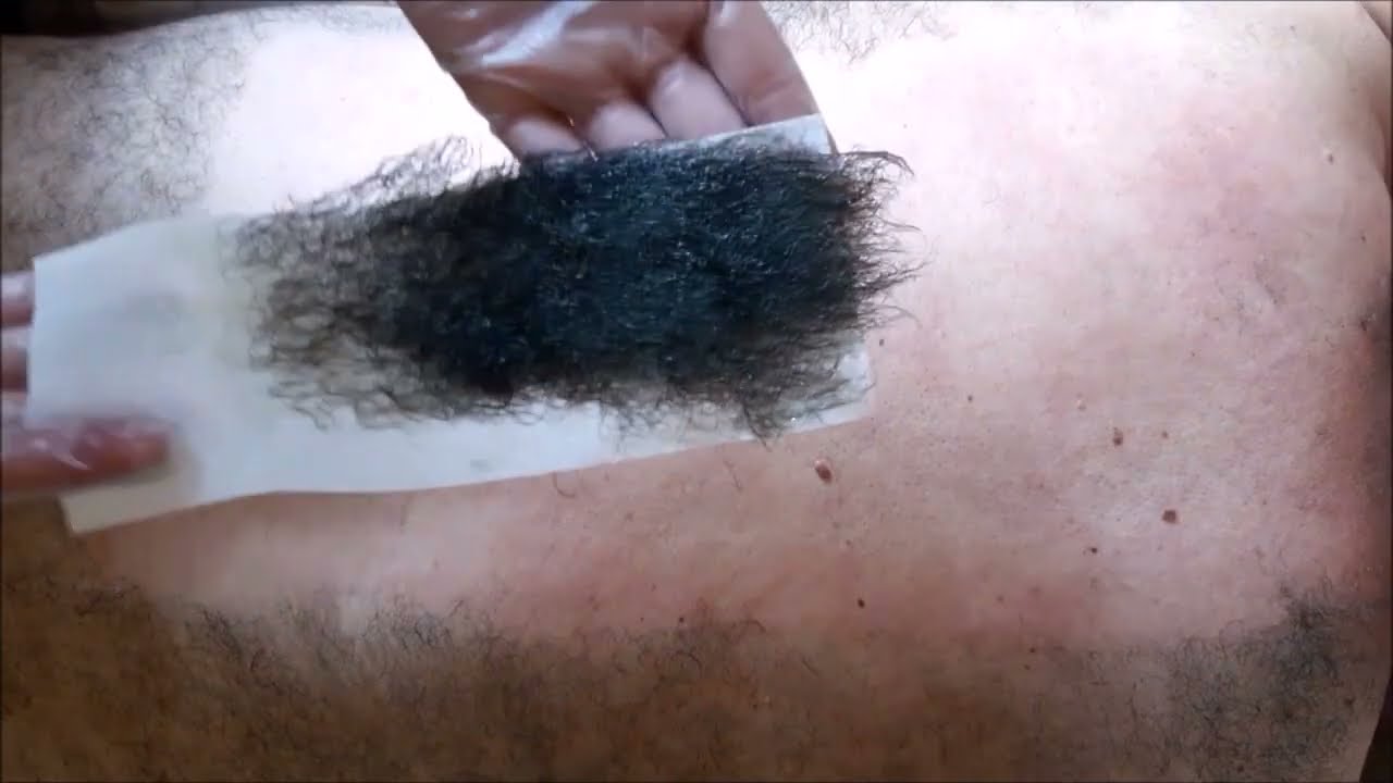 Depilação costa masculina.