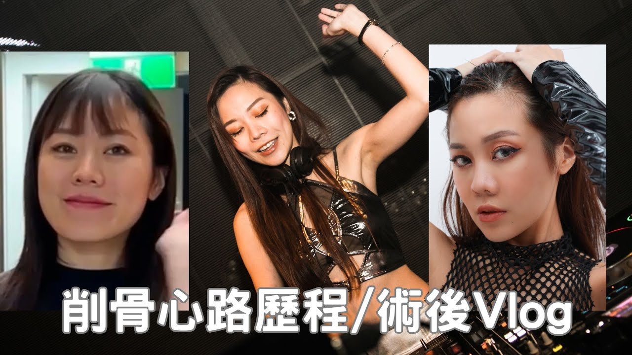 削骨心路歷程/手術恢復期Vlog