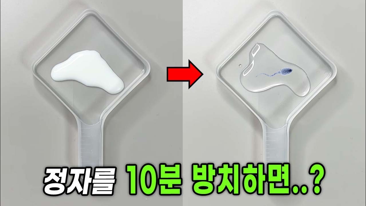 남자의 그것은 시간이 지나면 투명해집니다 - 정자 해부