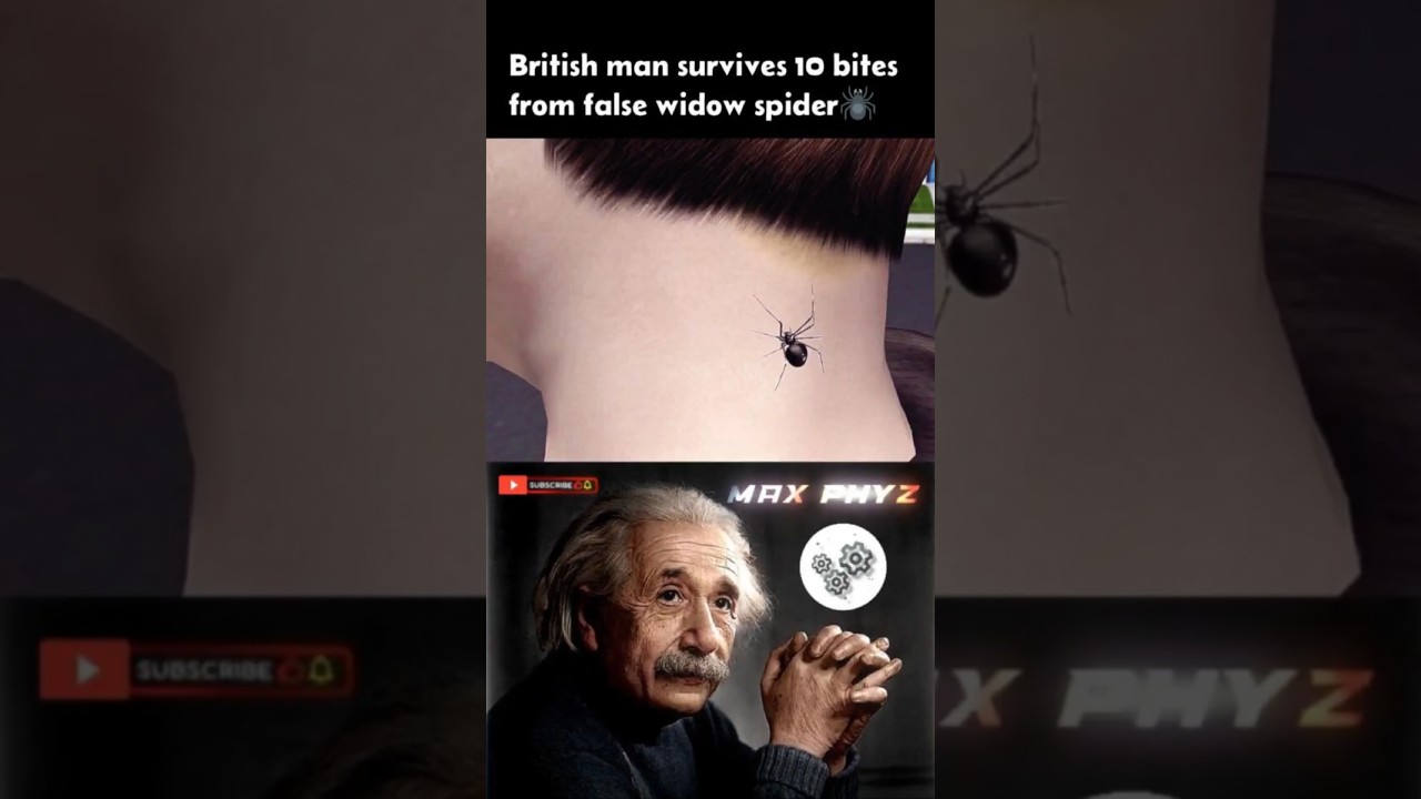 British Man Survives 10 False Widow Spider Bites😱 🇬🇧🕷️ 