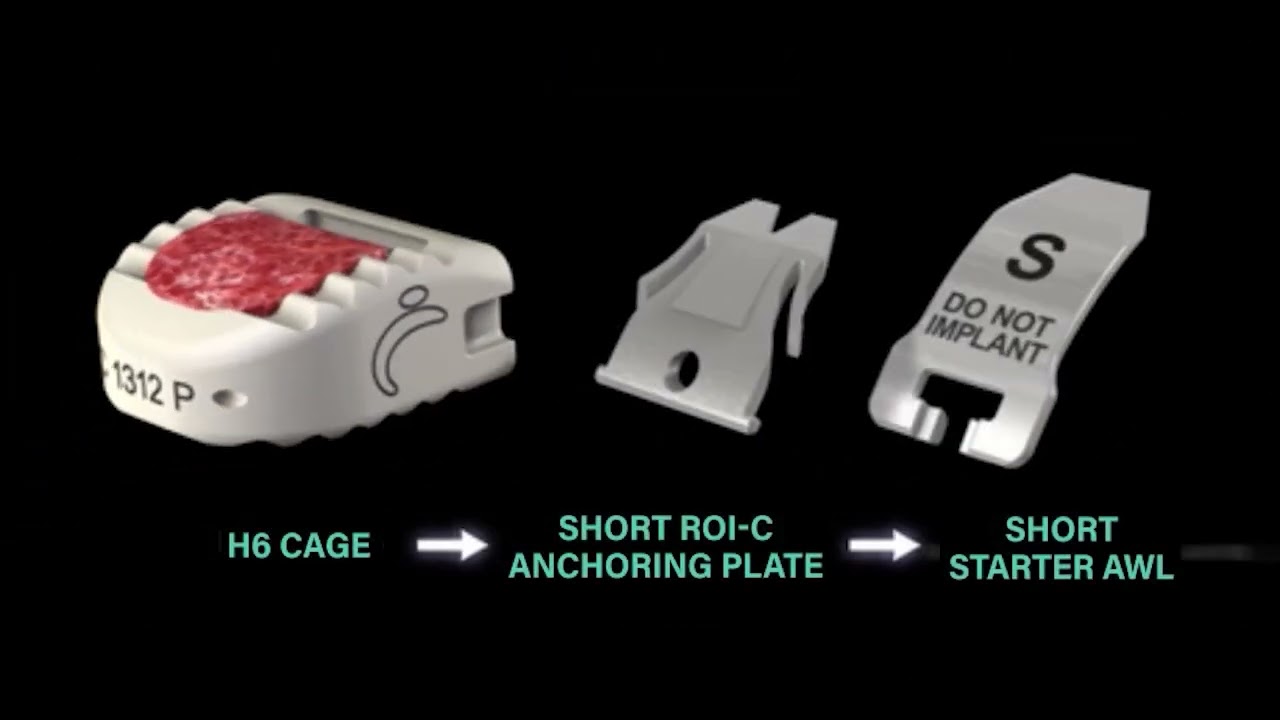 ROI C Titanium Coated Surgical Technique Animation Final