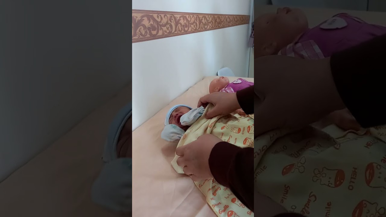 Senam Lidah Bayi Setelah Insisi Tongue Tie/Lip Tie