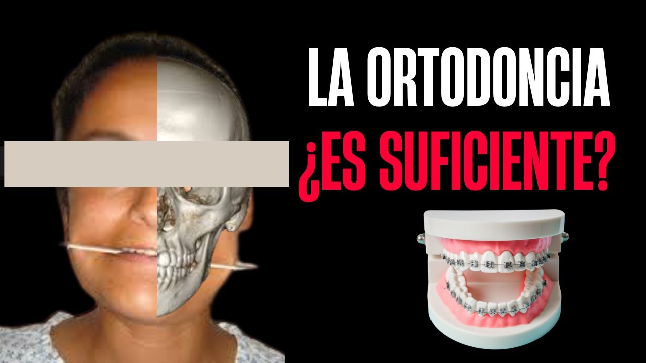 ¿Es suficiente la ORTODONCIA para tratar las asimetrías?  - Te explico en que casos NO!