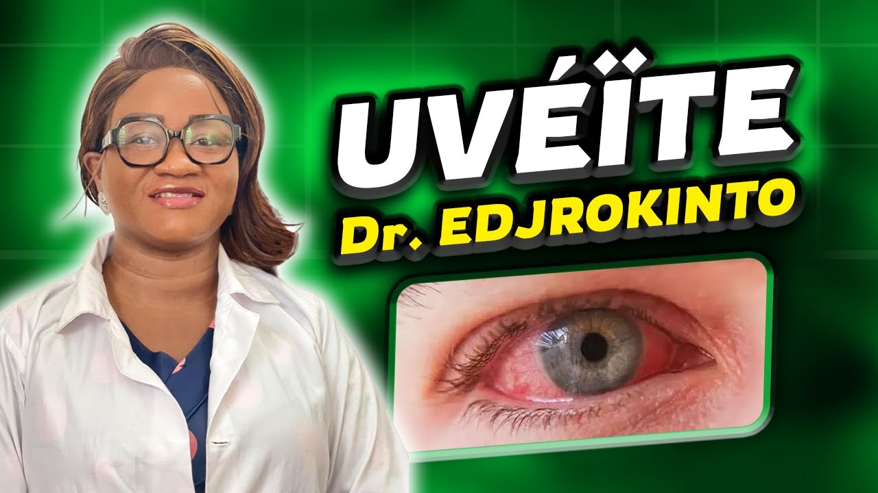 UVEITE Tout ce qu'il faut savoir
