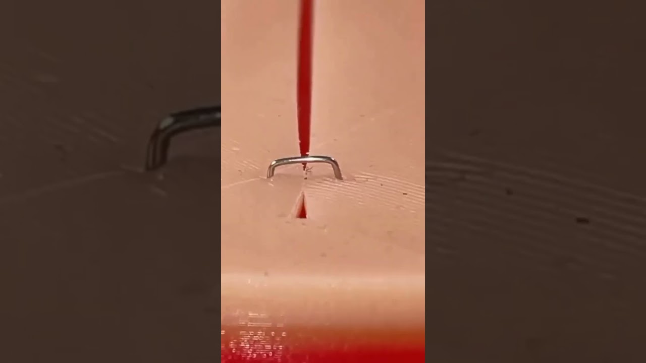 How medical staples are removed #health #youtubeshorts