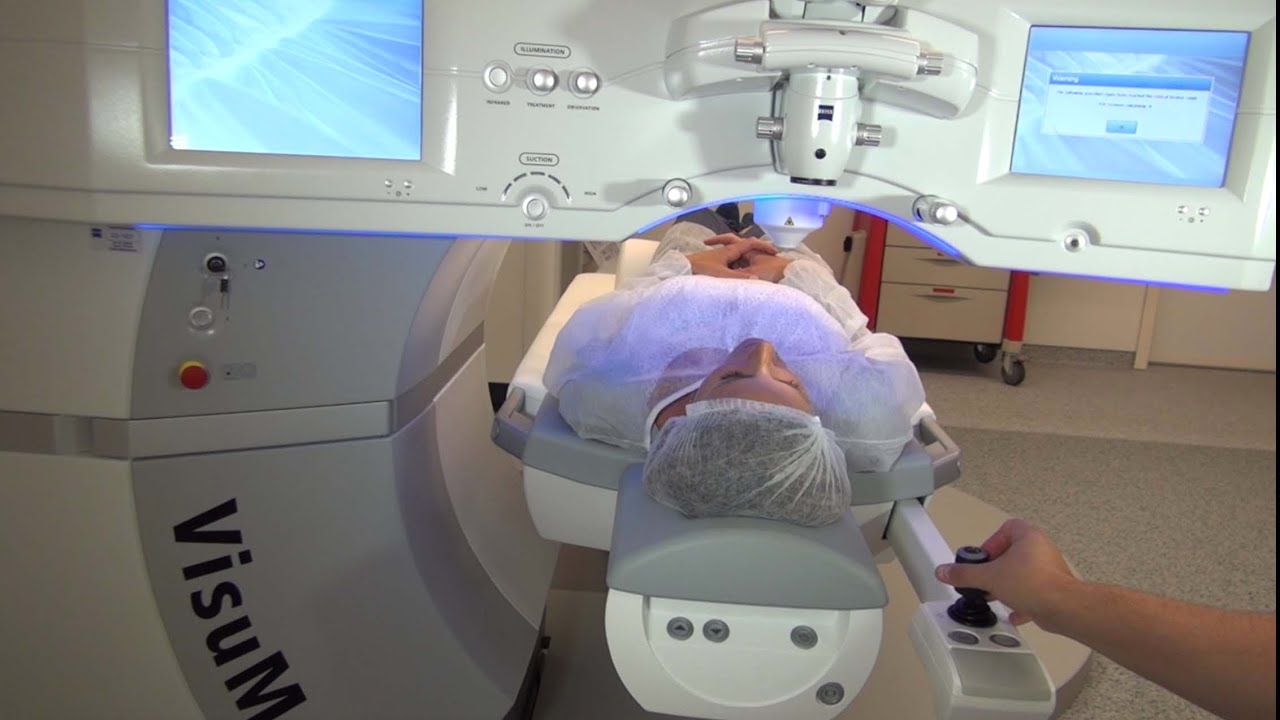 ReLEx smile: de behandeling (Nederlands)